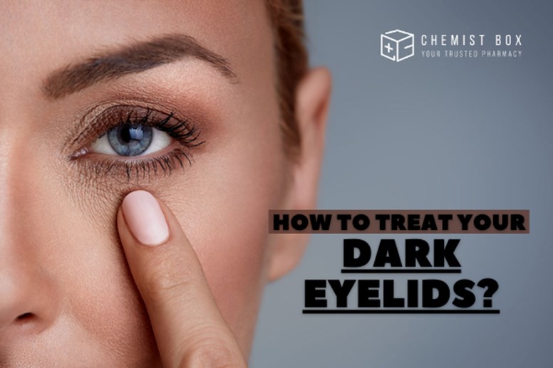 How To Treat Your Dark Eyelids? 