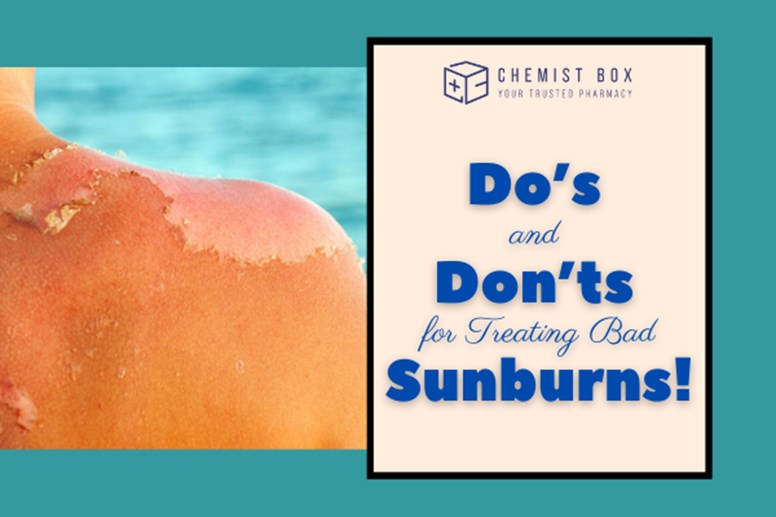 Do’s and Don’ts for Treating Bad Sunburns!